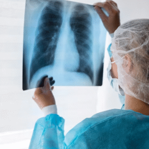 Application of Lung Ultrasound in Critical Care